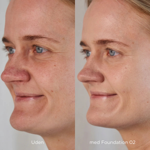 Foundation_02_5712350545517_before_after_.png